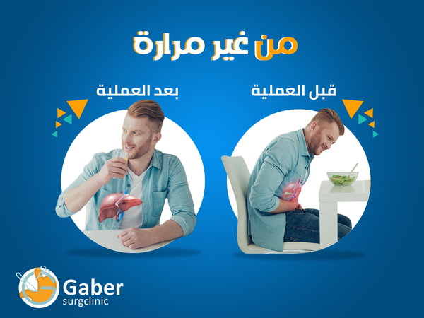 عملية المرارة في أسيوط