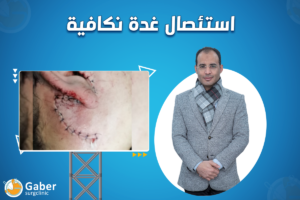 عملية الغدة النكافية